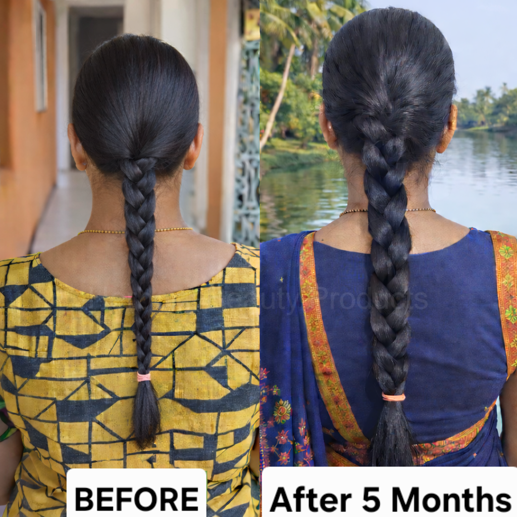 Before and after result