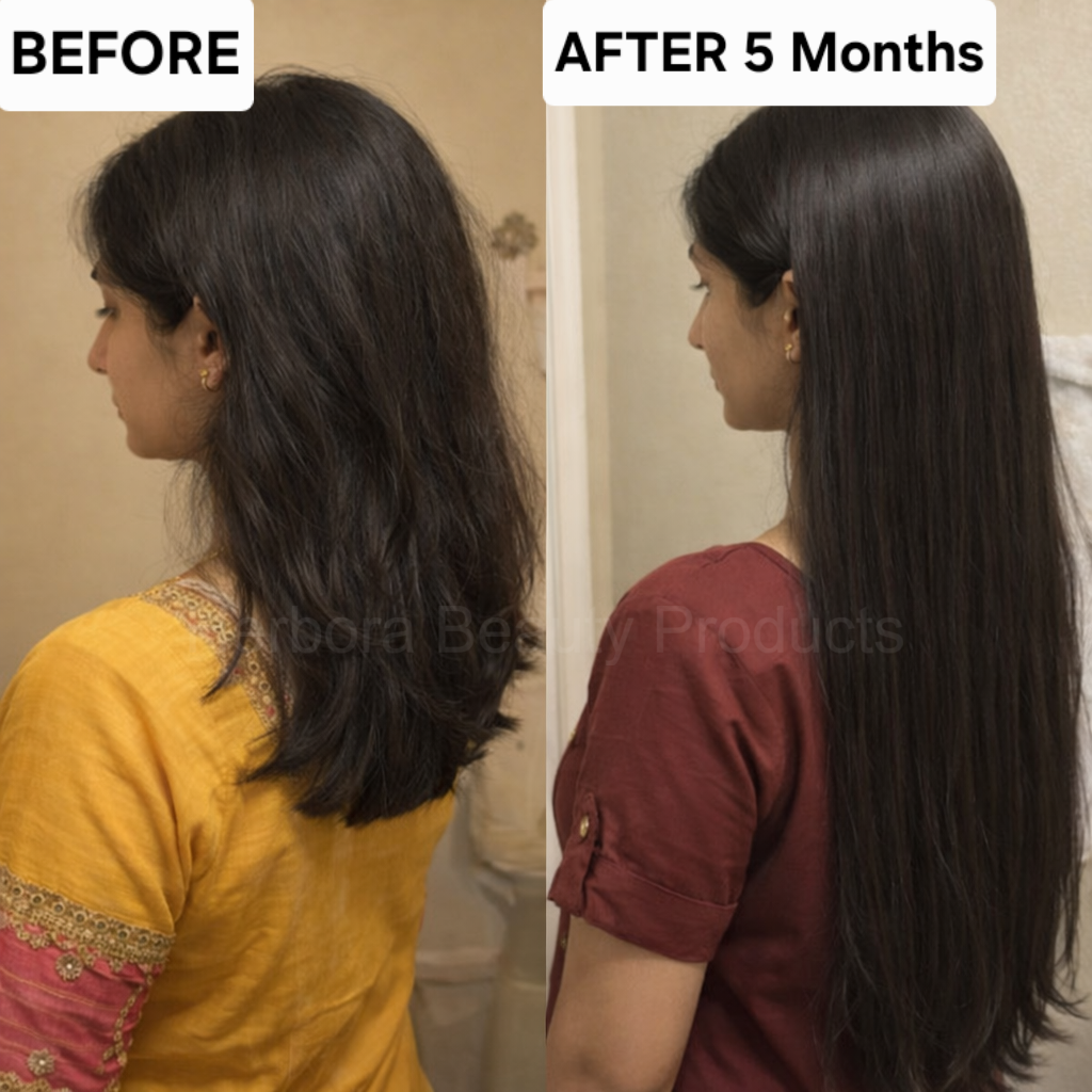 Before and after result