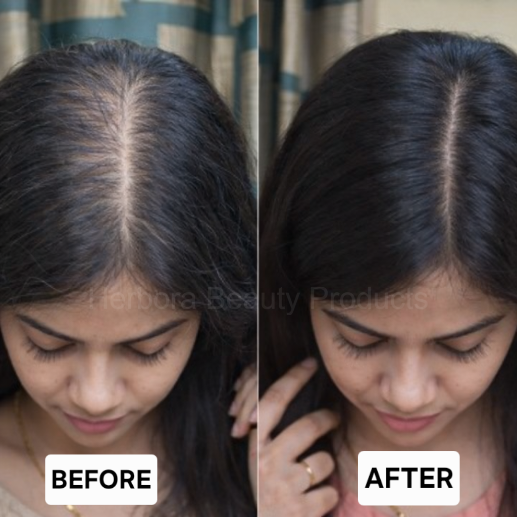 Before and after result