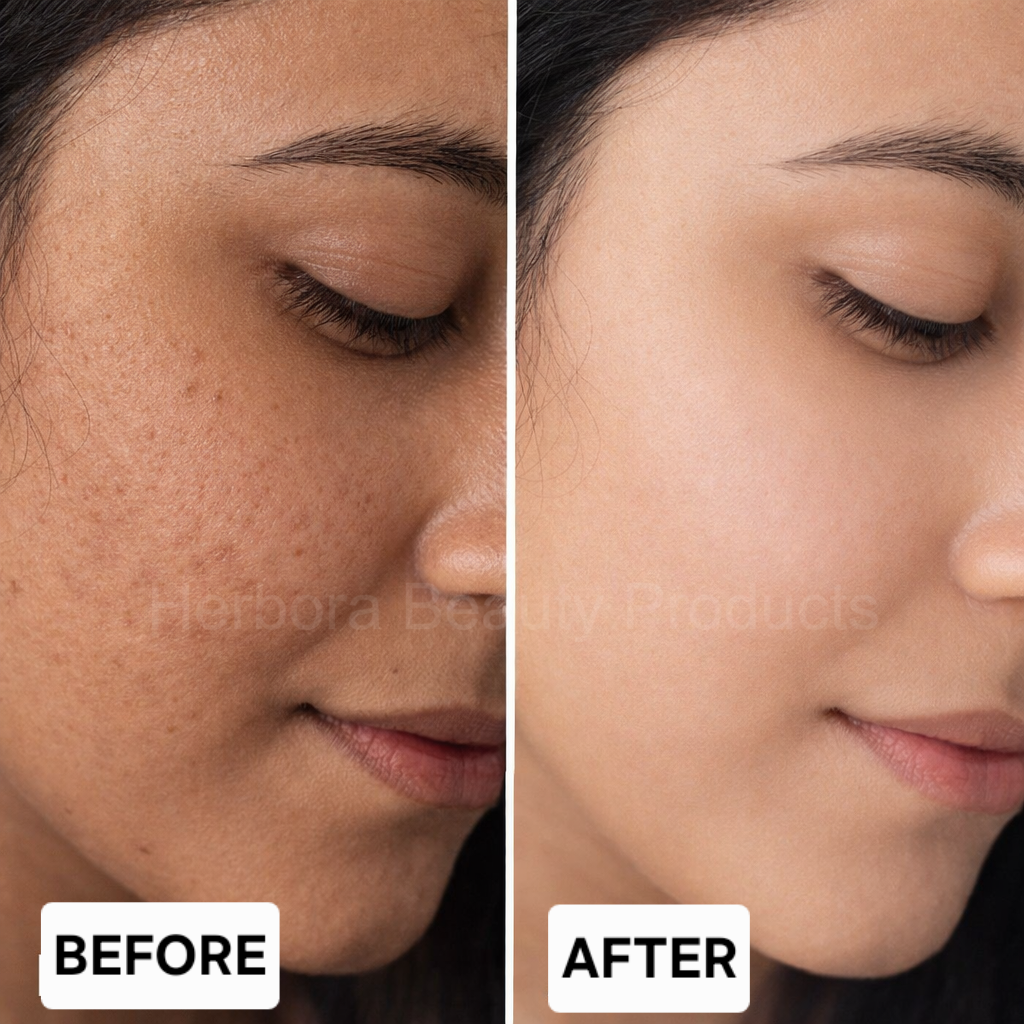 Before and after result