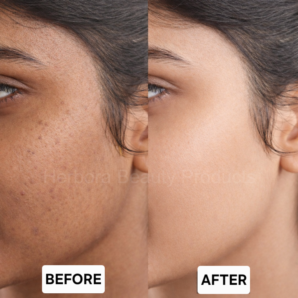 Before and after result